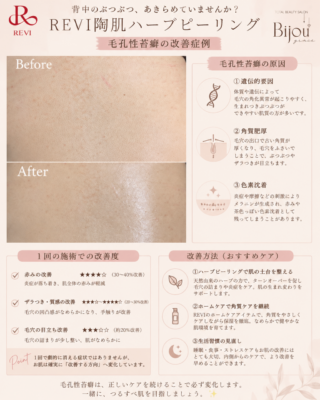 7800E308-3FA5-4016-8940-B2171EEE8AFA.png